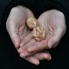 لوگوی کانال تلگرام abortion_ir — سقط جنین | بارداری ناخواسته