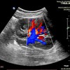 Логотип телеграм канала @atlas_ultrasound — УЗД Атлас. Atlas of Ultrasound