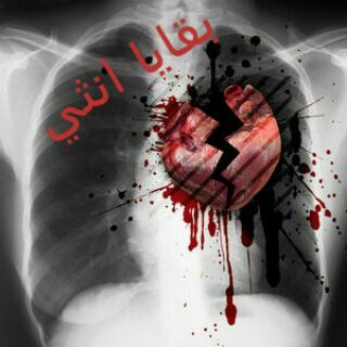 لوگوی کانال تلگرام bagaua — ♥ بـقــ أنـثـي ـــايــا ♥
