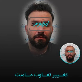 لوگوی کانال تلگرام clinic_irannovin — کاشت مو و ابرو با اقساط بلند مدت