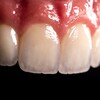 Логотип телеграм канала @dental_hacks — Зубной техник