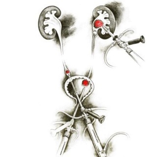 Логотип телеграм канала @end_of_urology — End Of Urology