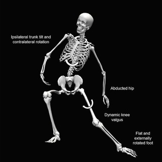 لوگوی کانال تلگرام exerciseismedicine — Exercise is Medicine (Science of Biomechanics, Sport Injuries, Pain and Movement Impairment Syndromes)