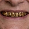 Логотип телеграм канала @frans_restik — ФРАНС