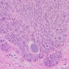 Логотип телеграм канала @gynpath — Гинопати