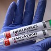 Логотип телеграм канала @hantavirus_2 — Хантавирус Новости | Hantavirus Пандемия