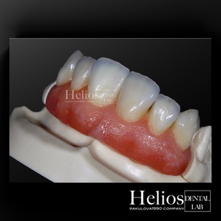 Логотип телеграм канала @helios_dental — Обучение стоматологов и зубных техников Helios