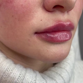 Логотип телеграм канала @kosmetologmoskva777 — Kosmetologmoskva777