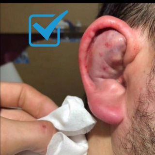 Логотип телеграм канала @lomkayshei — Ломаем уши без боли (инструкция)