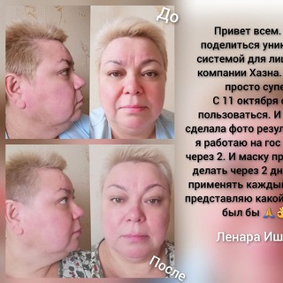 Логотип телеграм канала @maskasharm — 💥РЕЗУЛЬТАТЫ ПО ЛИФТИНГ-СИСТЕМЕ "SHARM"💥