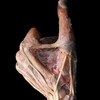 Логотип телеграм канала @med_surgeryy — Общая хирургия