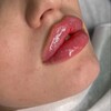 Логотип телеграм канала @olgabondareva_cosmetolog — OlyaBondareva