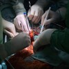 Логотип телеграм канала @oncosurgeon_life — PRO онкохирургию / Oncosurgeon life
