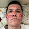 Логотип телеграм канала @oneflury — МАКИНФЛОР