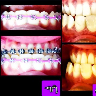 لوگوی کانال تلگرام orthodontics6mansoura — Dentistryand orthodontic