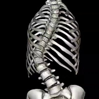 Логотип телеграм канала @smart_scoliosis — Всё о сколиозе