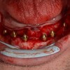 Логотип телеграм канала @surgeon_mozok — 🧠🦷 Surgeon mozok🦷🧠