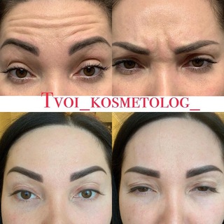 Логотип телеграм канала @tvoi_kosmetog — tvoi_kosmetolog