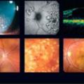Logo saluran telegram uveitis_books — Uveitis Books Channel