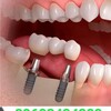 Telegram chat СПБ.Jamal Dental Clinic СПБ бесплатная реклама!!! 89602434309 logo